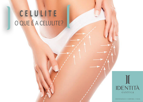 Saiba o que é celulite